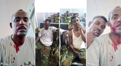 tigrayan-un-peace-keepres-attaced-in-South-Sudan